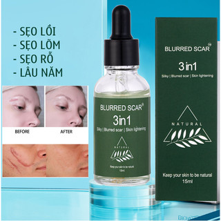 Serum Sẹo Lồi Lõm- Sẹo Rỗ Lâu Năm Blurred Scar