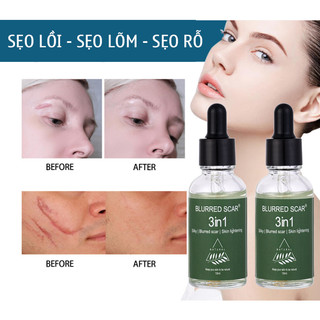 Serum Sẹo Lồi - Sẹo Lõm - Sẹo Rỗ Lâu Năm BLURRED