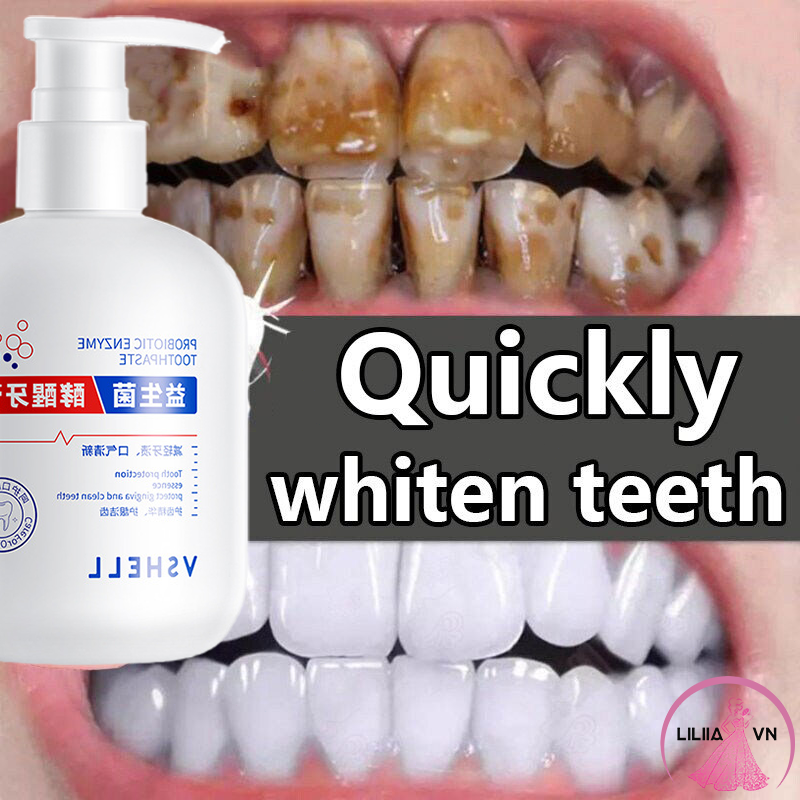 Kem Đánh Răng Làm Trắng Răng 250g Giảm Vết Ố Vàng Trên Răng giảm sâu răng Giữ Hơi Thở Thơm Mát