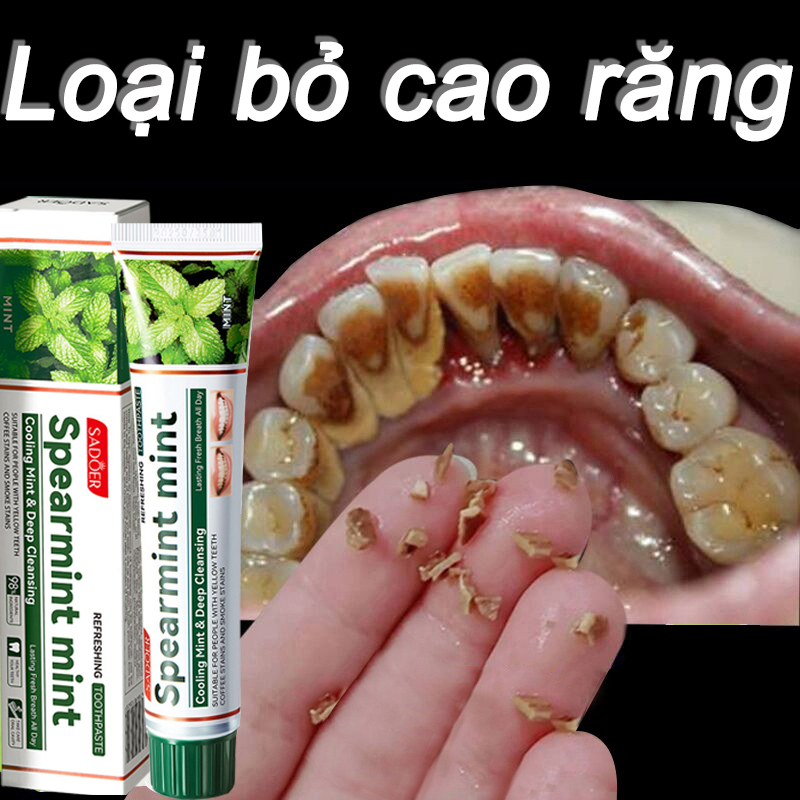 Kem đánh răng bạc hà 100g loại bỏ cao răng hôi miệng tẩy ố vàng Kem đánh