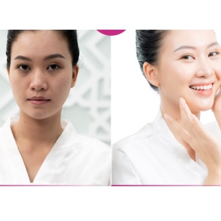 Viên Uống Trắng Da Mờ Nám Giảm Nếp Nhăn GLUTATHIONE 600 ĐR LACIR Hỗ Trợ Điều Trị Nám Tàn Nhang | BigBuy360 - bigbuy360.vn