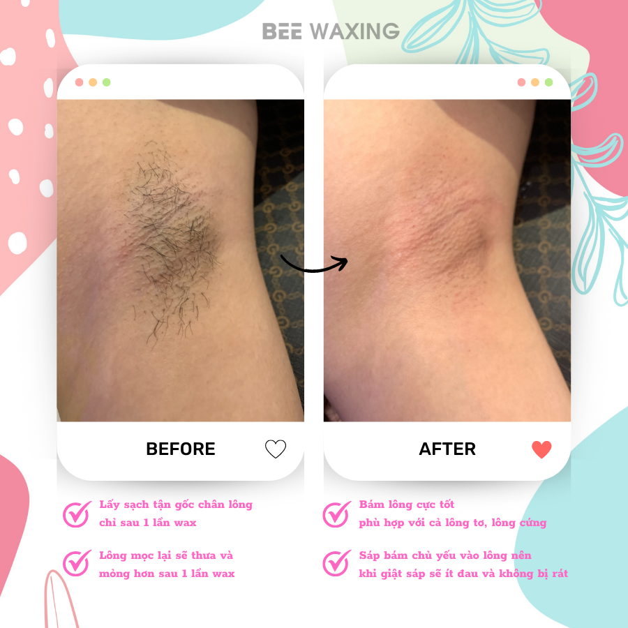 Sáp Wax Lông Nóng Cao Cấp Beewaxing Siêu Bám Lông - Wax lông tiện lợi tại nhà [Tặng Kèm Que Wax Tiệt Trùng]