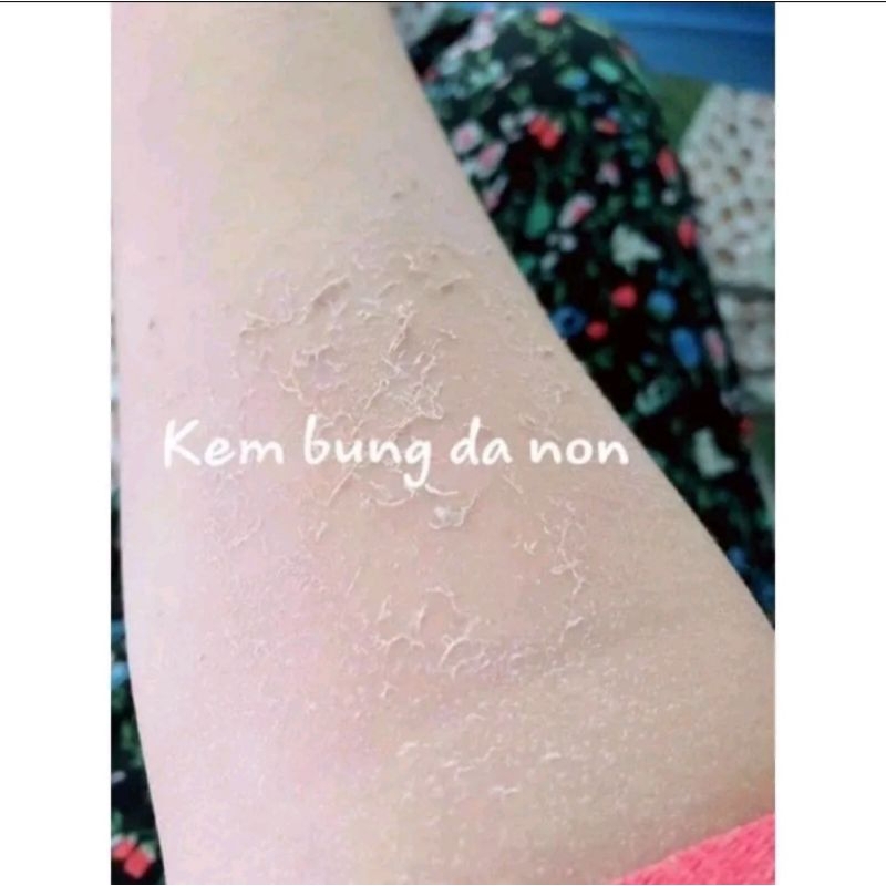 Kem body bong da tái tạo trắng sau 7 ngày