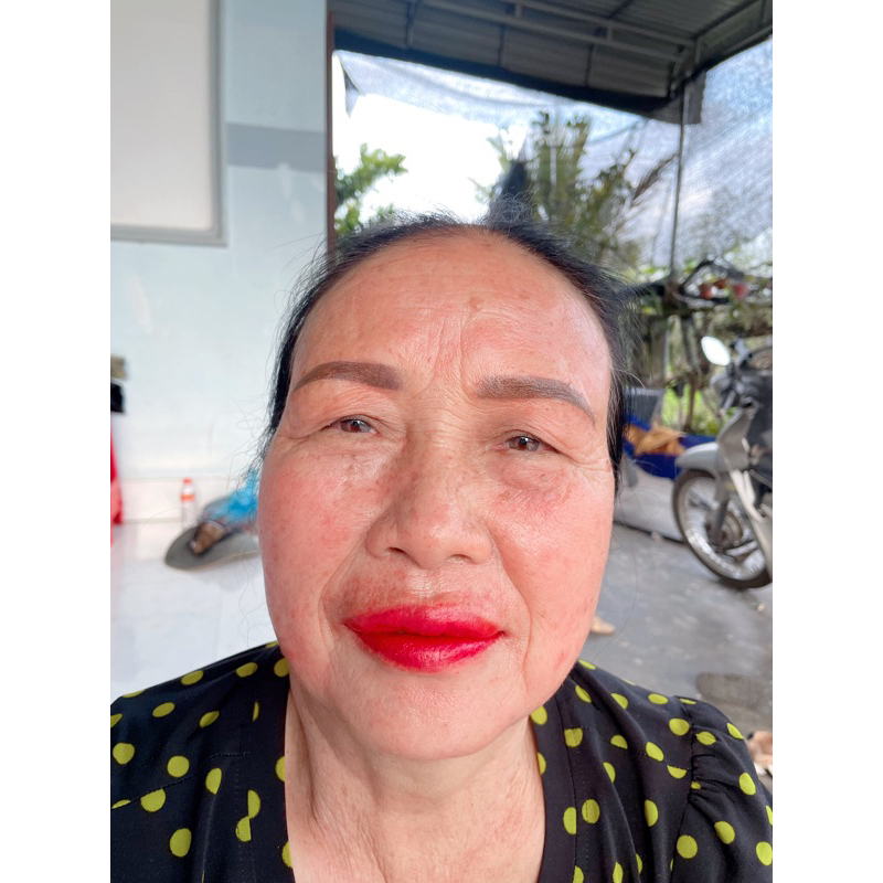 BỘ NÁM TÀN NHANG , MỤN LCL THÂM MẮT ,CHÂN SÂU DA NHIỀU NẾP NHĂN LÃO HOÁ DA BỊ  COD