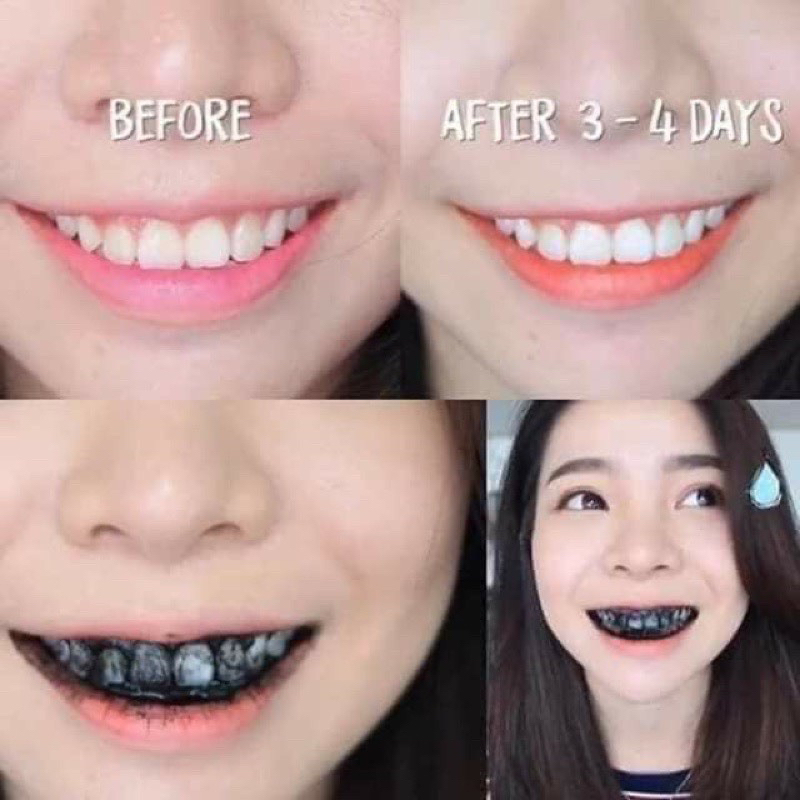 [ Mua 2 tặng 1 ] Bột Than Dừa Hoạt Tính Trắng Răng XT. | BigBuy360 - bigbuy360.vn