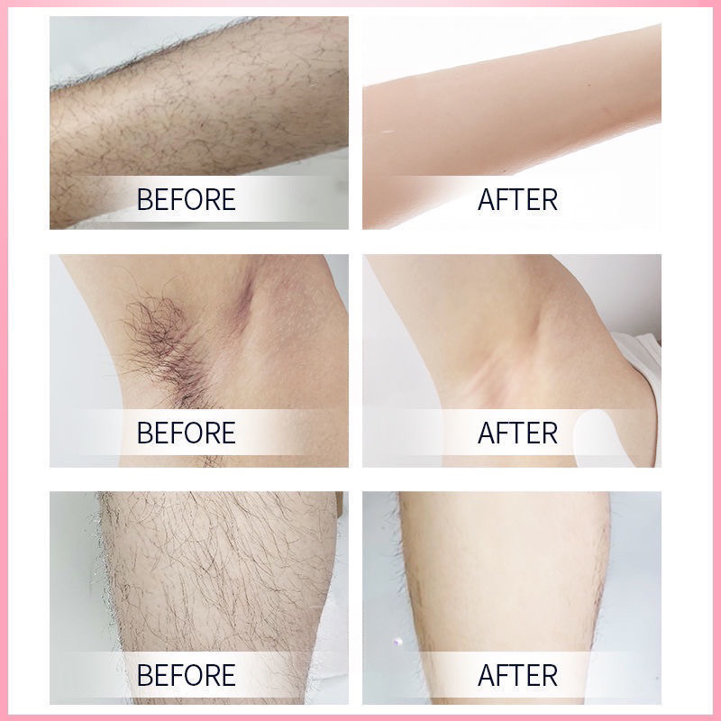 500G Sáp wax lông nóng cao cấp, wax lông nách tay chân, sáp wax ria mép túi lớn Lyihome