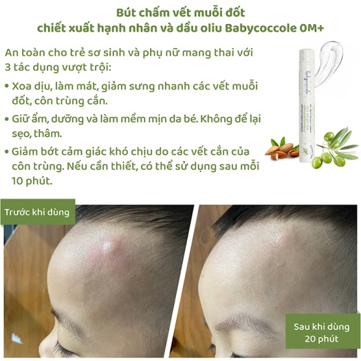 Đầu Lăn Giảm Vết Muỗi Đốt Hạnh Nhân - Dầu Oliu Babycoccole 10ml