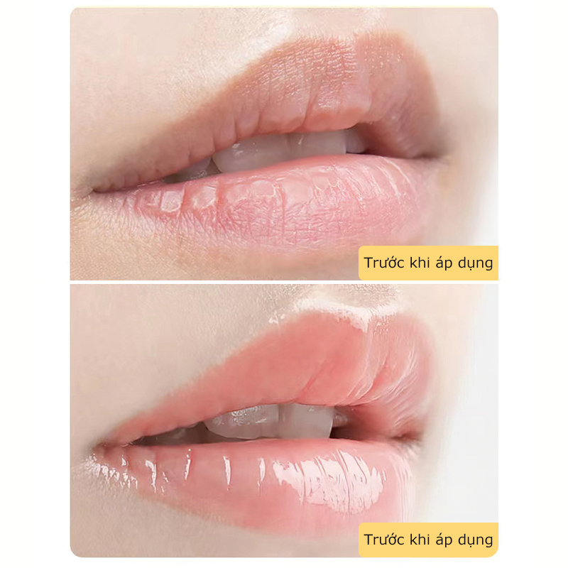 Dưỡng môi VASELINE 7g dạng hũ  cho  đủ vị