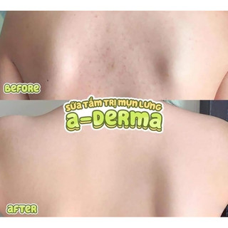 [Hà Hàng Đức] Sữa tắm A-Derma Eco Hydra-Protective 500ml