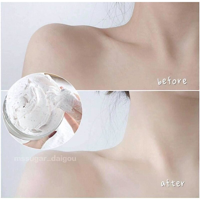 Tẩy tế bào chết body Dove xanh, hồng 225gr bản Đức