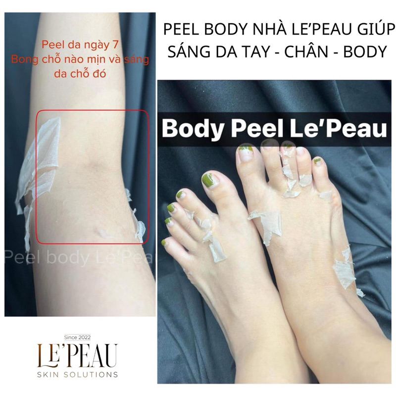 Peel Body Retinol LE'PEAU trắng da mờ thâm sau 7 ngày, loại bỏ tế bào chết cơ thể 50ml