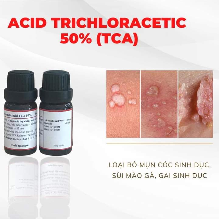 TCA MK 50% Giúp Xử Lý Sùi Mào Gà, Mụn Cóc, Gai sinh duc 5ml