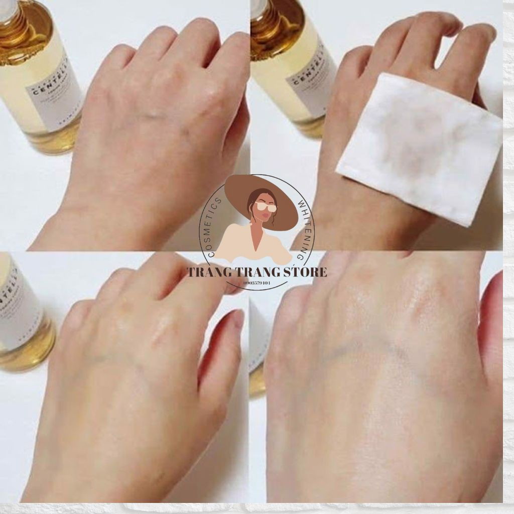 Nước Hoa Hồng Rau Má Skin 1004 Mandagasca Centella Toning Tone 210Ml | BigBuy360 - bigbuy360.vn