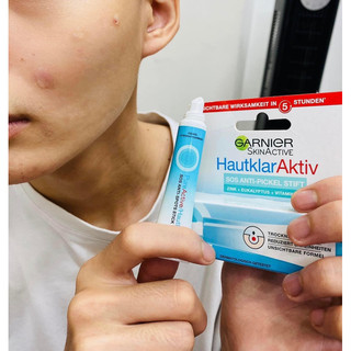 Bút tr.ị mụn cấp tốc của Garnier Hàng đức