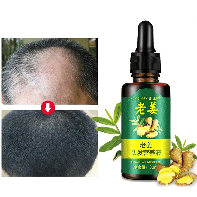 Serum gừng giúp tóc mọc nhanh chắc khỏe mềm mượt tự nhiên