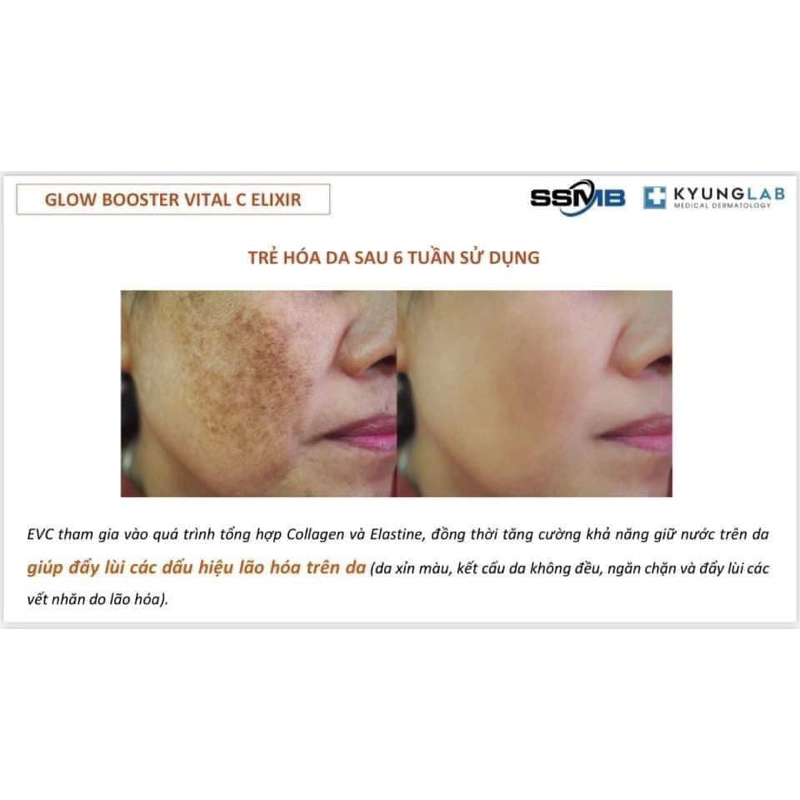 𝑆𝑒𝑟𝑢𝑚 𝑉𝑖𝑡𝑎𝑚𝑖𝑛 𝐶 𝐾𝑦𝑢𝑛𝑔𝐿𝑎𝑏 𝐺𝑙𝑜𝑤 𝐵𝑜𝑜𝑠𝑡𝑒𝑟 𝑉𝑖𝑡𝑎𝑙 𝐶 𝑚𝑜̛̀ 𝑡ℎ𝑎̂𝑚 𝑠𝑎́𝑛𝑔 𝑑𝑎 - 𝑡𝑎́𝑖 𝑠𝑖𝑛ℎ 𝑡𝑒̂́ 𝑏𝑎̀𝑜 𝑑𝑎 30𝑚𝑙