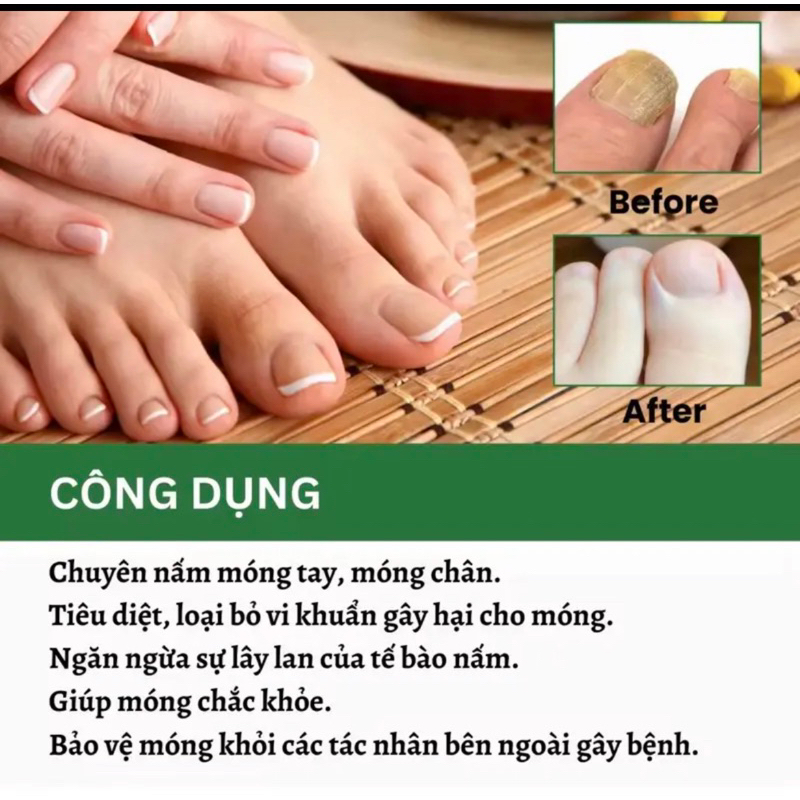Nấm Móng Và Hủ Dưỡng  HÀNG CHÍNH HÃNG