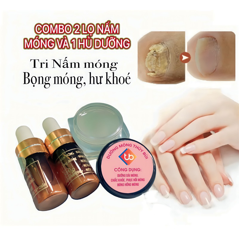 Nấm Móng Và Hủ Dưỡng  HÀNG CHÍNH HÃNG