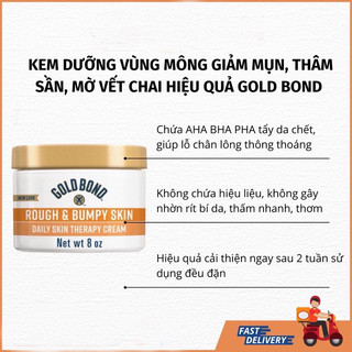   Auth_Bill Mỹ  kem dưỡng Body Gold Bond Mẫu Mới 
