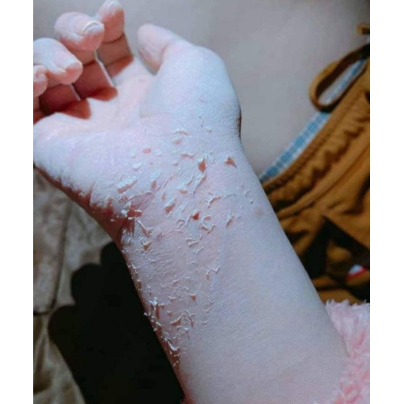 Kem body bong da tái tạo trắng sau 7 ngày