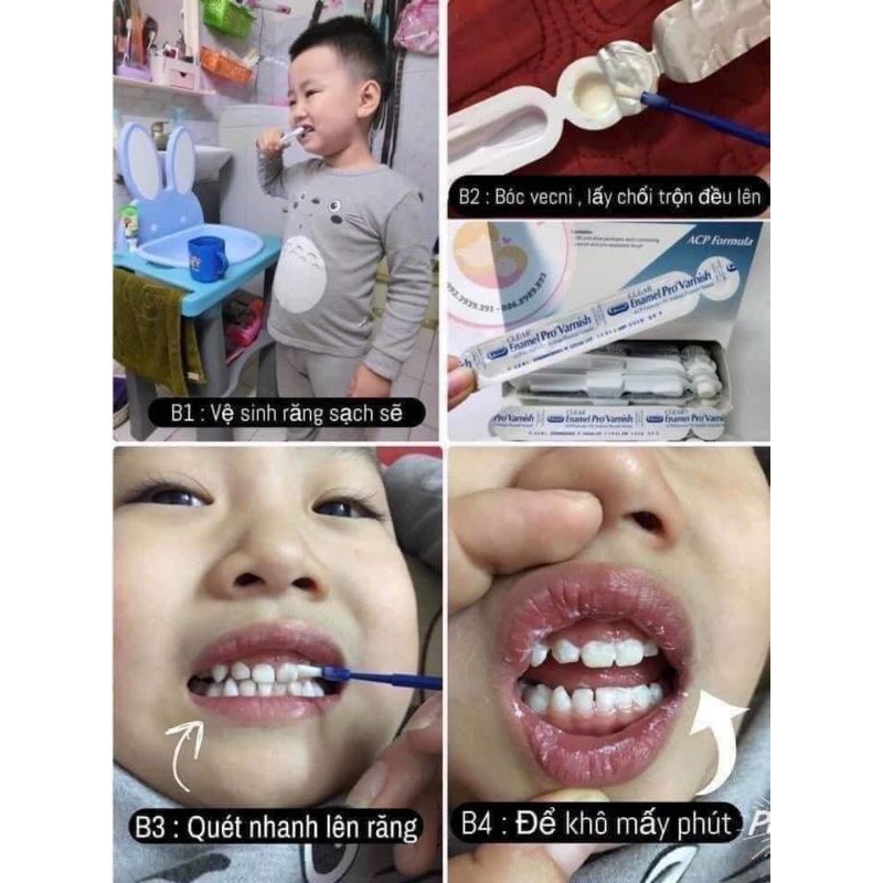 Vecni fluor chống sâu răng, hà mủn, trắng răng, ăn toàn cho trẻ từ 1 tuổi.