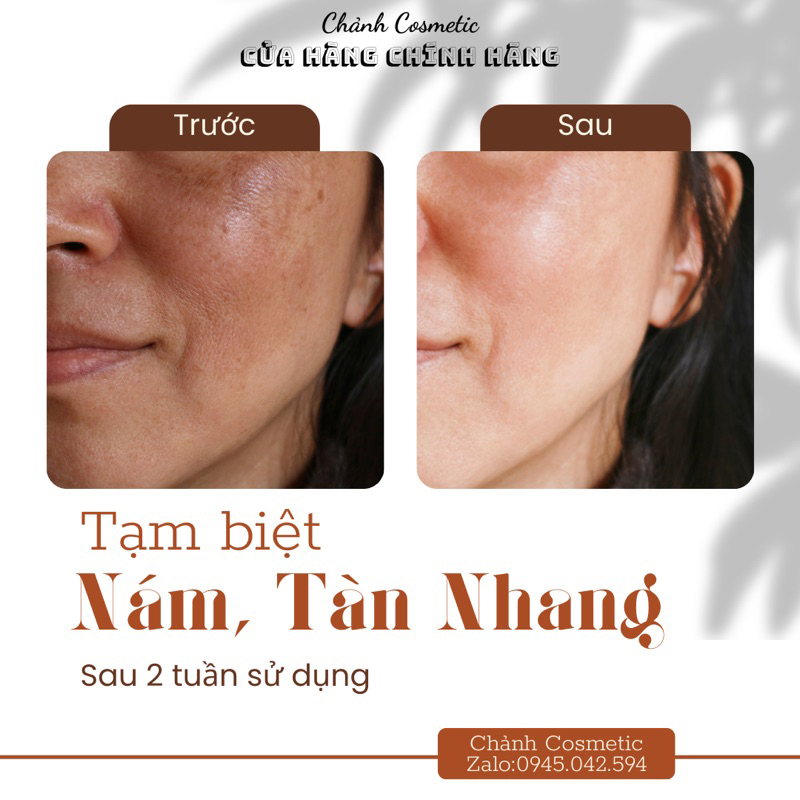 Serum Huyết Thanh Silex Nhật Bản Đa Chức Năng, Dưỡng Trắng Da, Ngừa Nám, Tàn Nhang, Ngừa Lão Hoá, Se Khít Chân Lông 30ml