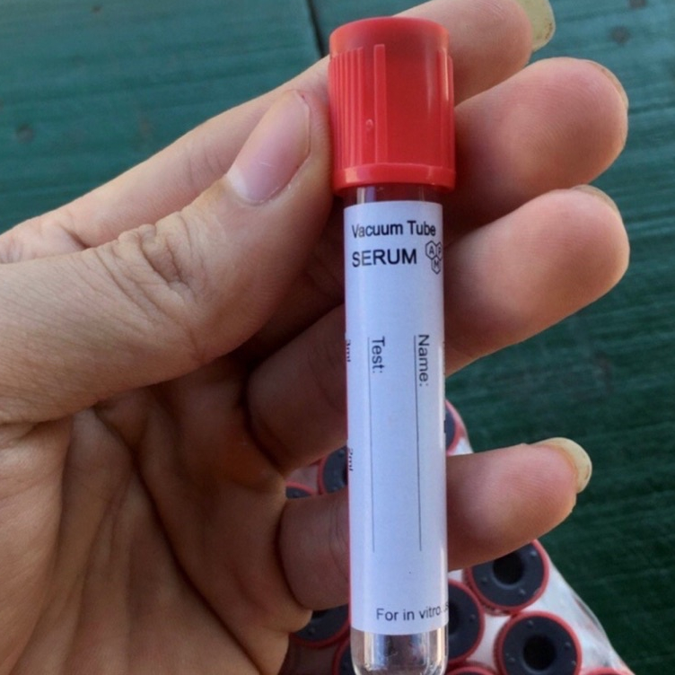 Combo100 ống nghiệm không có chất chống đông ứng dụng cho PRP và PRF