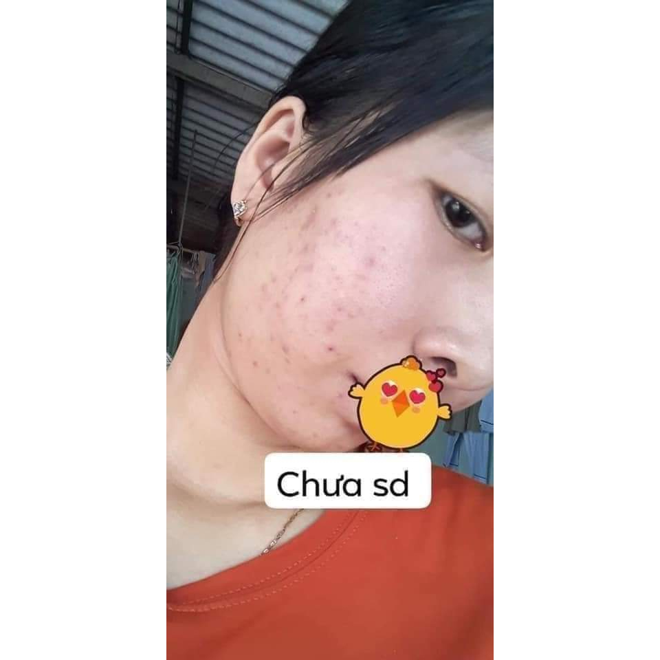 kem tuoi day thi huynh do