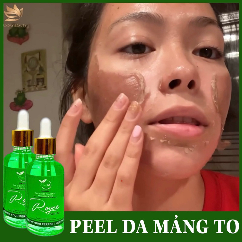[Peel Da] Peel Da Bong Mảng To Royce Skin M+ Thay Da Tách Sẹo Rỗ Lõm Nám Tàn Nhang Mụn Thâm
