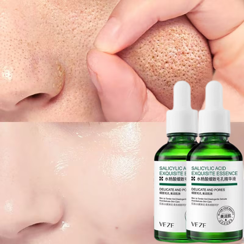 Serum se khít lỗ chân lông chống mụn tinh chất làm trắng 30ml giảm nếp nhăn mụn Se Khít Lỗ Chân làm trắng da