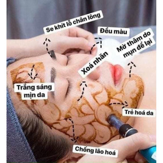 HỒNG SÂM GOGO CẤY TRẮNG.