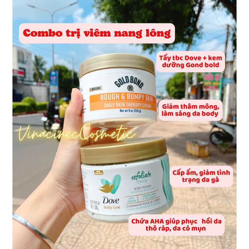 Kem dưỡng da Gold Bond Ultimate Rough & Bumpy Skin 226g