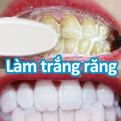 Kem đánh răng Làm trắng răng 180g Thở trong lành Tẩy Hết Ố Vàng Răng Giảm các vấn đề răng nhạy cảm