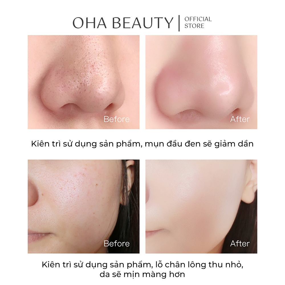 Mặt Nạ Bùn Đất Sét Cao Lanh Trà Xanh TWG 100g Giảm Mụn, Sáng Da, Làm Sạch Lỗ Chân Lông FM-0601