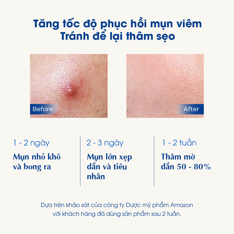 Bộ 4 Sản Phẩm Sahemul Chuyên Biệt Cho Da Dầu Mụn