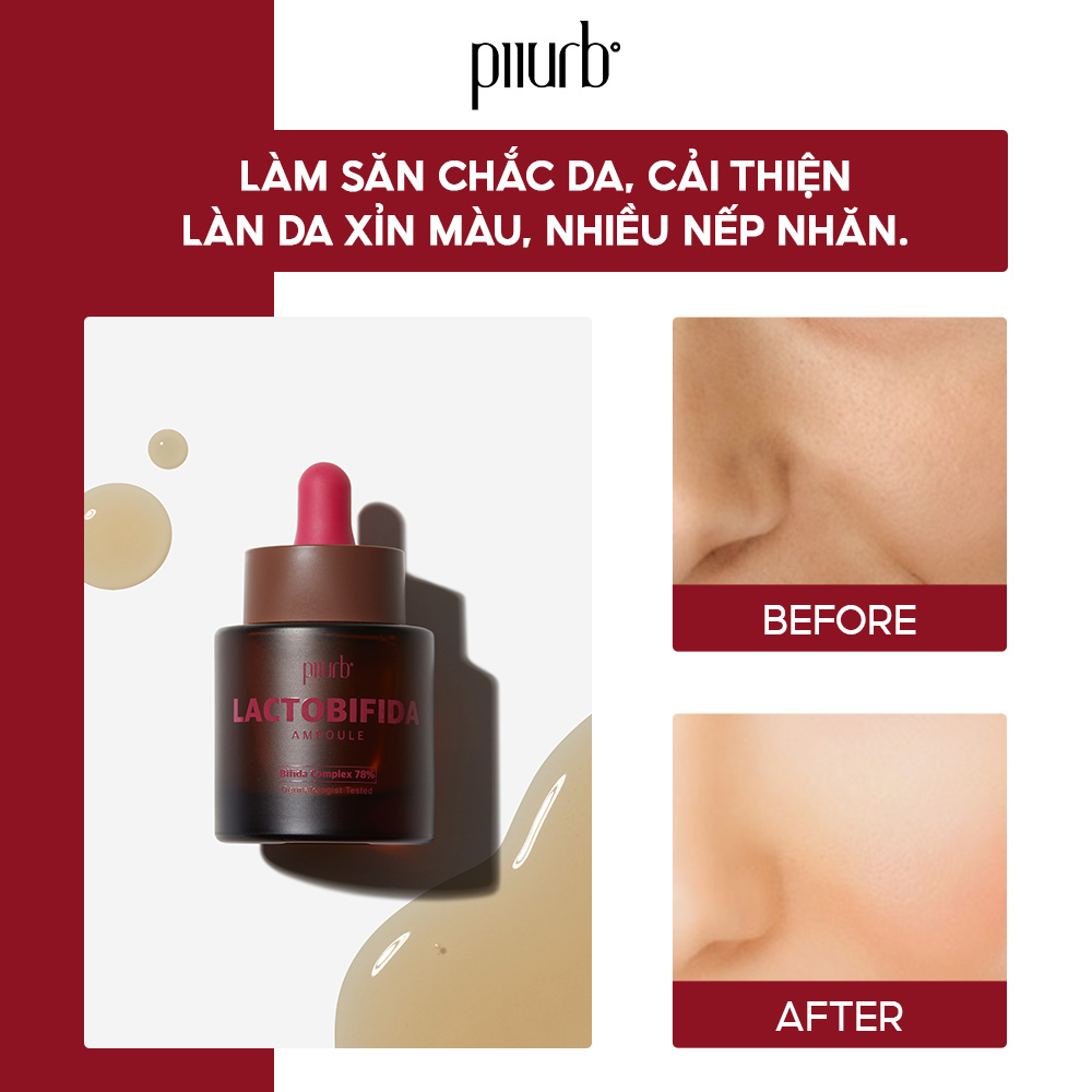 Tinh chất dưỡng da PIIURB IT'S REAL LACTOBIFIDA AMPOULE 30ml