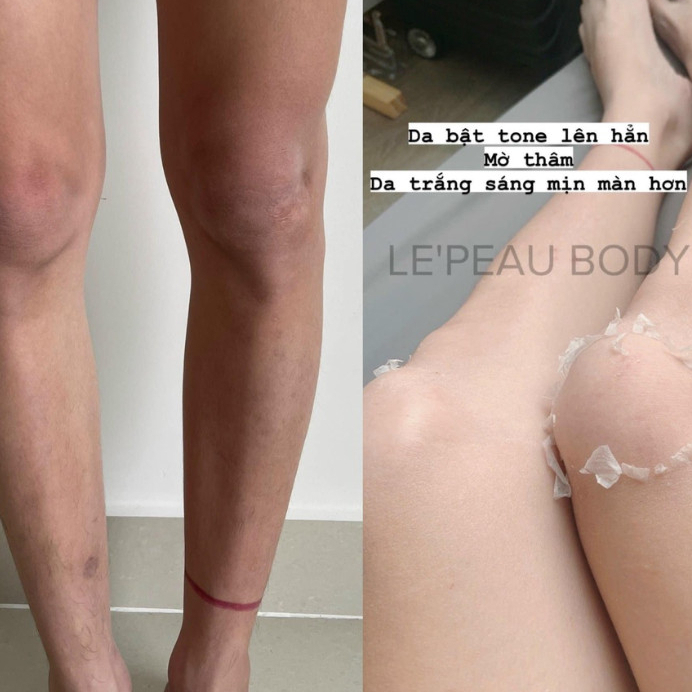 Peel da body LEPEAU, peel nách peel body retinol trắng da mờ thâm sạm dưỡng trắng da tặng kèm hủ khử thâm 150ml
