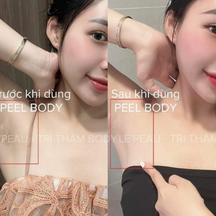 Peel da body LEPEAU, peel nách peel body retinol trắng da mờ thâm sạm dưỡng trắng da tặng kèm hủ khử thâm 150ml