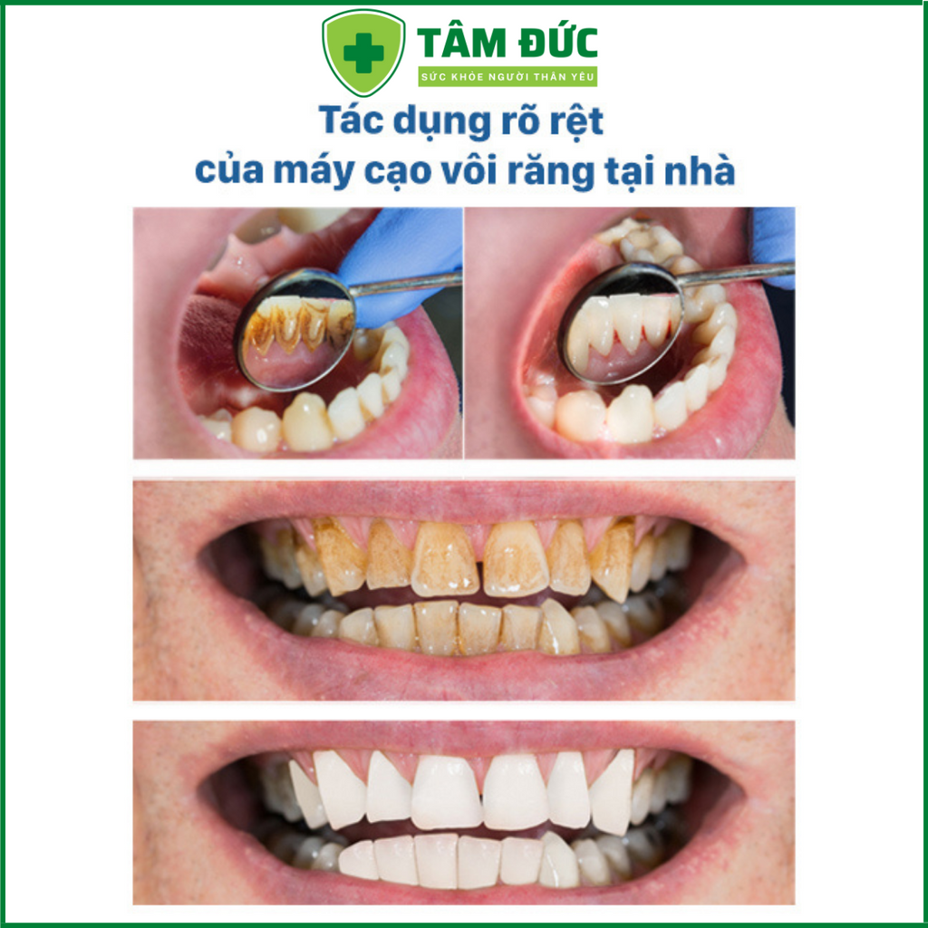 Máy lấy cao răng tại nhà 2 trong 1 kèm bàn chải điện sạc không dây, máy cạo cao răng đa năng HB75