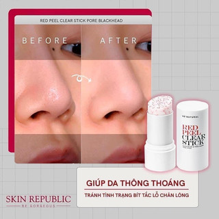 Thanh Lăn Đầu Đen Mụn Red Peel Clear Stick Pore Blackhead & Face
