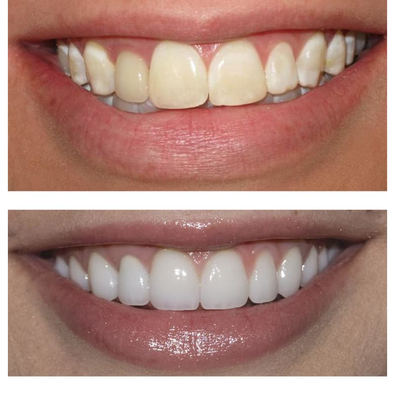 Kem Đánh Răng Marvis 10ml