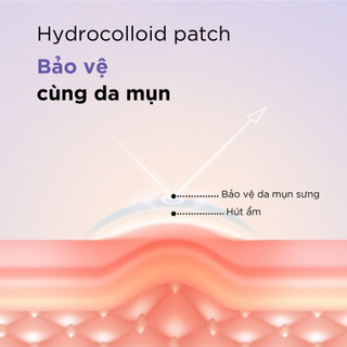 Miếng dán mụn siêu mỏng ISNTREE Newpair Spot Patch