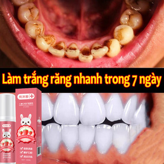 Tẩy trắng răng kem đánh răng làm trắng Mousse hơi thở thơm tho trắng răng khử mùi hôi miệng giảm vàng răng