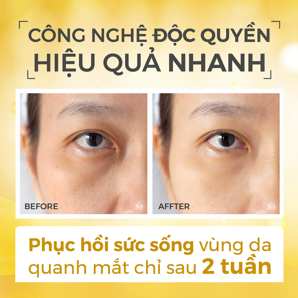 Kem dưỡng mắt RECIPE Lifting Recipe Dark Cover Eye Cream mờ thâm dưỡng sáng, giảm nếp nhăn 30ml