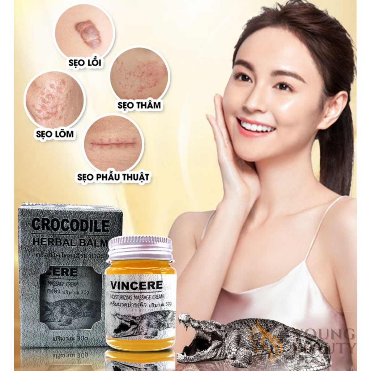 Cao nghệ đỏ lành sẹo VINCERE - Kem mờ sẹo từ mỡ cá sấu giúp lành sẹo lồi, sẹo lõm, sẹo thâm - YOUNG BEAUTY