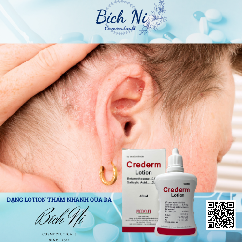 Kem dưỡng Crederm lotion 40ml cùng công thức Beprosalic lotion - Chăm sóc da Chàm, Vẩy nến, Nấm da đầu.