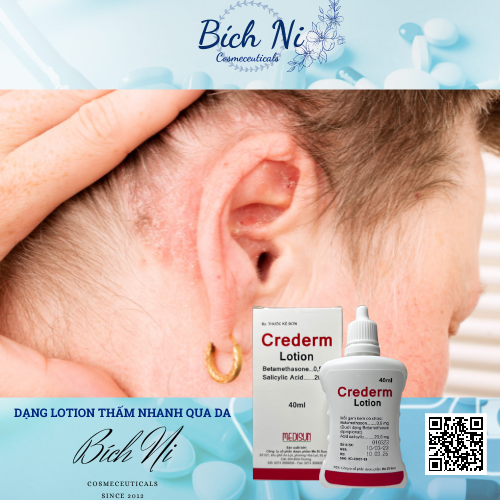 Crederm lotion 40ml dung dịch chăm sóc da Chàm, Vẩy nến, Nấm da đầu