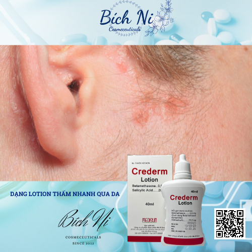 Crederm lotion 40ml dung dịch chăm sóc da Chàm, Vẩy nến, Nấm da đầu