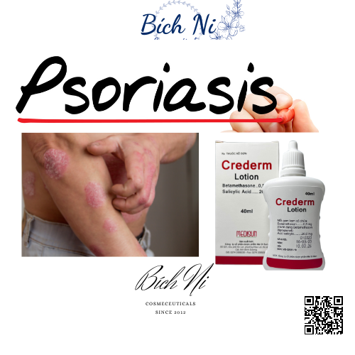 Crederm lotion 40ml dung dịch chăm sóc da Chàm, Vẩy nến, Nấm da đầu