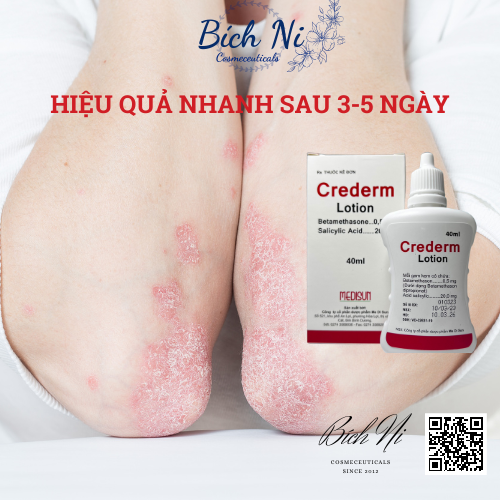 Crederm lotion 40ml dung dịch chăm sóc da Chàm, Vẩy nến, Nấm da đầu